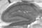 Discs Large MAGUK Scaffold Protein 1 antibody, 75-030, Antibodies Incorporated, Immunohistochemistry paraffin image 