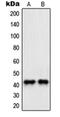 Pro-Apoptotic WT1 Regulator antibody, orb214360, Biorbyt, Western Blot image 