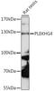 Pleckstrin Homology And RhoGEF Domain Containing G4 antibody, 16-438, ProSci, Western Blot image 