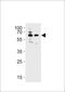 Beta-Transducin Repeat Containing E3 Ubiquitin Protein Ligase antibody, LS-C203776, Lifespan Biosciences, Western Blot image 