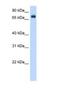 Cytochrome P450 Oxidoreductase antibody, NBP1-59780, Novus Biologicals, Western Blot image 