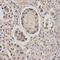 Core-Binding Factor Subunit Beta antibody, LS-C333969, Lifespan Biosciences, Immunohistochemistry paraffin image 