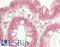 SEC61 Translocon Beta Subunit antibody, LS-B14043, Lifespan Biosciences, Immunohistochemistry paraffin image 