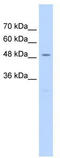 RAD23 Homolog A, Nucleotide Excision Repair Protein antibody, TA346392, Origene, Western Blot image 