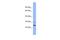 Protein Phosphatase, Mg2+/Mn2+ Dependent 1B antibody, A05731, Boster Biological Technology, Western Blot image 