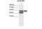 Aldehyde Dehydrogenase 1 Family Member B1 antibody, 27-162, ProSci, Western Blot image 