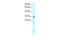 Homeobox B9 antibody, PA5-40576, Invitrogen Antibodies, Western Blot image 