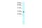 Homeobox B9 antibody, PA5-40576, Invitrogen Antibodies, Western Blot image 