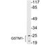 Glutathione S-Transferase Mu 1 antibody, LS-C199878, Lifespan Biosciences, Western Blot image 