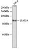 Signal Transducer And Activator Of Transcription 5A antibody, 23-141, ProSci, Western Blot image 