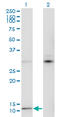 Mature T Cell Proliferation 1 antibody, LS-C197713, Lifespan Biosciences, Western Blot image 