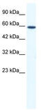 DEAD-Box Helicase 5 antibody, TA341565, Origene, Western Blot image 