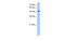 Delta/Notch Like EGF Repeat Containing antibody, MBS834699, MyBioSource, Western Blot image 