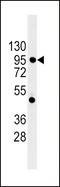 Cadherin 1 antibody, MBS9210542, MyBioSource, Western Blot image 