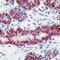 O-6-Methylguanine-DNA Methyltransferase antibody, LS-C88208, Lifespan Biosciences, Immunohistochemistry frozen image 