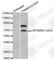 Ribosomal Protein S6 Kinase B1 antibody, AP0253, ABclonal Technology, Western Blot image 