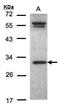 Origin Recognition Complex Subunit 6 antibody, GTX104685, GeneTex, Western Blot image 