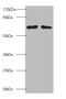 BMI1 Proto-Oncogene, Polycomb Ring Finger antibody, A53945-100, Epigentek, Western Blot image 