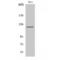 Atrophin 1 antibody, LS-C382208, Lifespan Biosciences, Western Blot image 