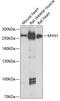 AF4/FMR2 Family Member 1 antibody, A02590, Boster Biological Technology, Western Blot image 