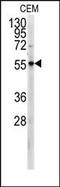 PKM antibody, AP13828PU-N, Origene, Western Blot image 