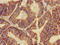 Glycerol-3-Phosphate Acyltransferase, Mitochondrial antibody, LS-C678116, Lifespan Biosciences, Immunohistochemistry paraffin image 