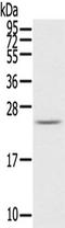 RAB2A, Member RAS Oncogene Family antibody, TA350318, Origene, Western Blot image 