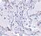 Telomerase Associated Protein 1 antibody, PA5-20354, Invitrogen Antibodies, Immunohistochemistry paraffin image 