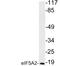 Eukaryotic Translation Initiation Factor 5A2 antibody, LS-B11417, Lifespan Biosciences, Western Blot image 