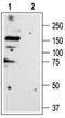 Glycine Receptor Alpha 3 antibody, TA328848, Origene, Western Blot image 