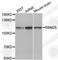 RNA Binding Motif Protein 25 antibody, A8340, ABclonal Technology, Western Blot image 