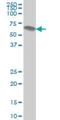 ATPase H+ Transporting Accessory Protein 1 antibody, H00000537-M01, Novus Biologicals, Western Blot image 