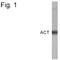 Serpin Family A Member 3 antibody, PA1-4150, Invitrogen Antibodies, Western Blot image 
