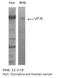 Respiratory Syncytial Virus Glycoprotein F antibody, NBP2-50156, Novus Biologicals, Western Blot image 