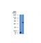 ALK Receptor Tyrosine Kinase antibody, M00301, Boster Biological Technology, Western Blot image 