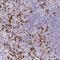 Regulator Of Calcineurin 2 antibody, NBP2-30409, Novus Biologicals, Immunohistochemistry paraffin image 