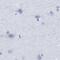 Radial Spoke Head Component 1 antibody, PA5-53497, Invitrogen Antibodies, Immunohistochemistry paraffin image 