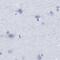 Radial spoke head 1 homolog antibody, PA5-53497, Invitrogen Antibodies, Immunohistochemistry paraffin image 