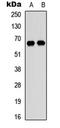 DExD-Box Helicase 52 antibody, LS-C358465, Lifespan Biosciences, Western Blot image 