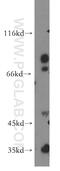Calcium Voltage-Gated Channel Auxiliary Subunit Gamma 5 antibody, 18498-1-AP, Proteintech Group, Western Blot image 