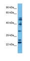 ZFP41 Zinc Finger Protein antibody, orb325607, Biorbyt, Western Blot image 
