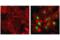 HIF1-alpha antibody, 36169T, Cell Signaling Technology, Immunofluorescence image 