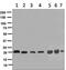 Interleukin 1 Receptor Antagonist antibody, ab124962, Abcam, Western Blot image 