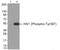 Hematopoietic Cell-Specific Lyn Substrate 1 antibody, 79-926, ProSci, Western Blot image 