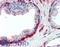 ANTXR Cell Adhesion Molecule 2 antibody, LS-B15853, Lifespan Biosciences, Immunohistochemistry paraffin image 