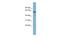 Dynactin Subunit 4 antibody, A10417, Boster Biological Technology, Western Blot image 