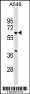 Metal Response Element Binding Transcription Factor 2 antibody, 59-772, ProSci, Western Blot image 