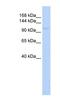 Zinc Finger And BTB Domain Containing 11 antibody, NBP1-80327, Novus Biologicals, Western Blot image 