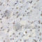 Proteasome Subunit Beta 10 antibody, A5452, ABclonal Technology, Immunohistochemistry paraffin image 
