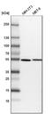 SAMM50 Sorting And Assembly Machinery Component antibody, NBP1-84509, Novus Biologicals, Western Blot image 